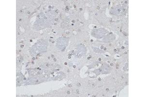 Immunohistochemistry of paraffin-embedded Mouse brain using USP7 Polyclonal Antibody at dilution of 1:100 (40x lens). (USP7 antibody)