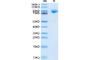 Cynomolgus KLKB1 on Tris-Bis PAGE under reduced condition. (KLKB1 Protein (AA 20-638) (His tag))