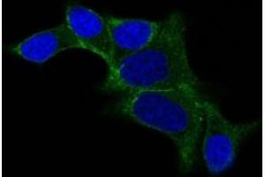 Immunofluorescent staining of LNCap cells with ODC1 monoclonal antibody, clone ODC1/487  (Green). (ODC1 antibody)