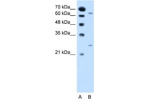WB Suggested Anti-NAT2 Antibody Titration:  2. (NAT2 antibody  (Middle Region))
