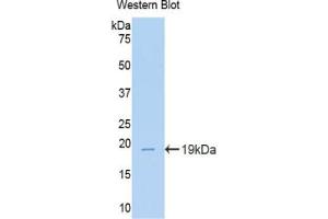 Western blot analysis of the recombinant protein. (TNC antibody  (AA 356-495))