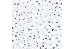 Immunohistochemistry of paraffin-embedded rat liver using ELF5 Rabbit pAb (ABIN6130882, ABIN6140130, ABIN6140131 and ABIN6222999) at dilution of 1:50 (40x lens). (ELF5 antibody  (AA 1-170))
