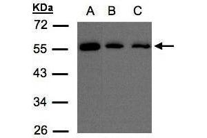 WB Image Sample(30 μg of whole cell lysate) A:H1299 B:Hep G2, C:MOLT4 , 10% SDS PAGE antibody diluted at 1:500