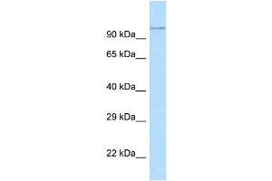 WB Suggested Anti-Adam29 Antibody   Titration: 1.