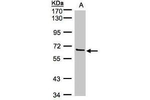 WB Image Sample(30 μg of whole cell lysate) A:293T 7. (Factor XI antibody)