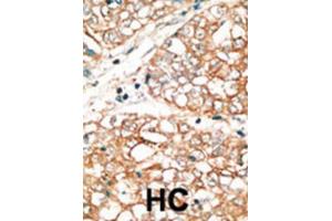 Immunohistochemistry (IHC) image for anti-BCL2-Related Ovarian Killer (BOK) (BH3 Domain) antibody (ABIN2997148) (BOK antibody  (BH3 Domain))