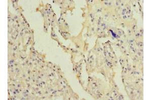Immunohistochemistry of paraffin-embedded human lung tissue using ABIN7165382 at dilution of 1:100 (FAM124B antibody  (AA 146-272))