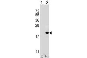 Western blot analysis of UBE2V1 antibody and 293 cell lysate (2 ug/lane) either nontransfected (Lane 1) or transiently transfected (2) with the UBE2V1 gene. (UBE2V1 antibody  (AA 113-145))