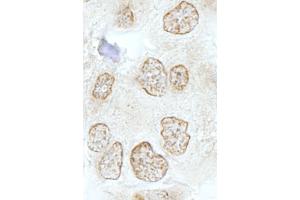 Immunohistochemistry (IHC) image for anti-SSB1 (AA 161-211) antibody (ABIN7448816) (SSB1 (AA 161-211) antibody)