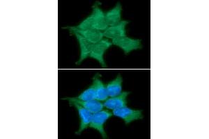 ICC/IF analysis of PPM1G in 293T cells line, stained with DAPI (Blue) for nucleus staining and monoclonal anti-human PPM1G antibody (1:100) with goat anti-mouse IgG-Alexa fluor 488 conjugate (Green)