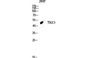 Western Blot (WB) analysis of 293T lysis using TSLC1 antibody.