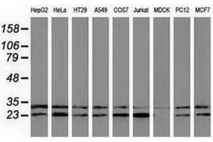 Western blot analysis of extracts (35 µg) from 9 different cell lines by using anti-CLPP monoclonal antibody. (CLPP antibody)