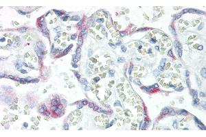Detection of KISS1 in Human Placenta Tissue using Monoclonal Antibody to Kisspeptin 1 (KISS1) (KISS1 antibody  (AA 20-138))