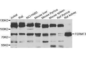 Western blot analysis of extracts of various cells, using FERMT3 antibody. (FERMT3 antibody)
