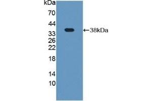 Detection of Recombinant Plg, Rat using Polyclonal Antibody to Plasminogen (Plg) (PLG antibody  (AA 191-433))