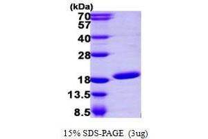 UBE2N Protein (AA 1-152) (His tag)