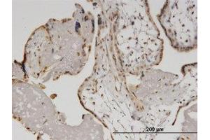 Image no. 4 for anti-Helicase with Zinc Finger (HELZ) (AA 1-101) antibody (ABIN599500) (HELZ antibody  (AA 1-101))