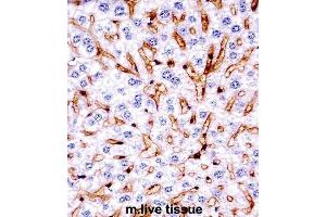 Immunohistochemistry (IHC) image for anti-Mitogen-Activated Protein Kinase 11 (MAPK11) antibody (ABIN2997621) (MAPK11 antibody)