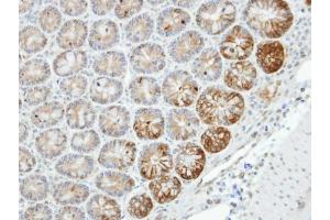 IHC-P Image Immunohistochemical analysis of paraffin-embedded human small intestine, using MST4, antibody at 1:100 dilution. (STK26/MST4 antibody  (C-Term))