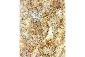 Anti-Annexin VI antibody, IHC(F) IHC(F): Rat Spleen Tissue (ANXA6 antibody  (C-Term))