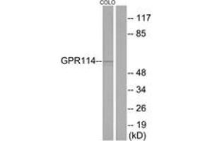 Western blot analysis of extracts from COLO205 cells, using GPR114 Antibody. (GPR114 antibody  (AA 91-140))