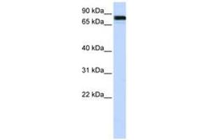 Image no. 1 for anti-Ewing Sarcoma Breakpoint Region 1 (EWSR1) (AA 216-265) antibody (ABIN6743005) (EWSR1 antibody  (AA 216-265))