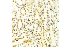 Immunohistochemistry of paraffin-embedded human kidney using DKC1 Antibody (ABIN5970956) at dilution of 1/100 (40x lens). (DKC1 antibody)