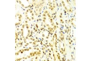 Immunohistochemistry of paraffin-embedded human kidney using DKC1 Antibody (ABIN5970956) at dilution of 1/100 (40x lens).