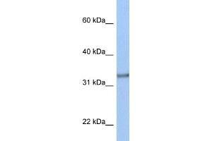 WB Suggested Anti-ACBD4 Antibody Titration:  0. (ACBD4 antibody  (N-Term))
