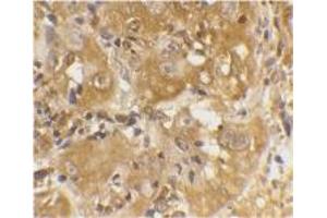 Image no. 1 for anti-BCL2-Like 11 (Apoptosis Facilitator) (BCL2L11) (Internal Region) antibody (ABIN201915) (BIM antibody  (Internal Region))