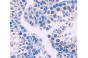 Used in DAB staining on fromalin fixed paraffin- embedded testis tissue (TYMS antibody  (AA 36-313))