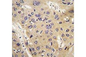 Immunohistochemistry (IHC) image for anti-Autophagy Related 12 (ATG12) antibody (ABIN3028485)