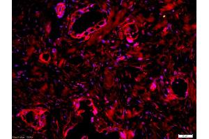 Formalin-fixed and paraffin embedded human lung labeled with Anti-CD162 Polyclonal Antibody, Unconjugated (ABIN679298) at 1:200 followed by conjugation to the secondary antibody Goat Anti-Rabbit IgG, Cy3 conjugated used at 1:200 dilution for 40 minutes at 37°C and DAPI staining (SELPLG antibody  (AA 251-350))