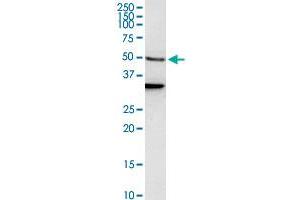 EEF1A1 polyclonal antibody (A01). (eEF1A1 antibody  (AA 156-255))
