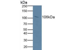 Figure. (Retinoblastoma 1 antibody  (AA 639-778))