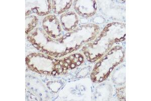 Immunohistochemistry (IHC) image for anti-Glutamate Dehydrogenase 1 (GLUD1) (AA 54-240) antibody (ABIN6141157)