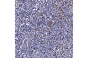 Immunohistochemical staining of human tonsil with ZC3H12B polyclonal antibody  shows distinct cytoplasmic positivity in subsets of cells. (ZC3H12B antibody)