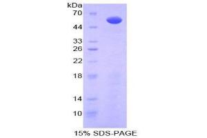 SDS-PAGE (SDS) image for Glypican 3 (GPC3) (AA 343-559) protein (His tag,GST tag) (ABIN2122925)