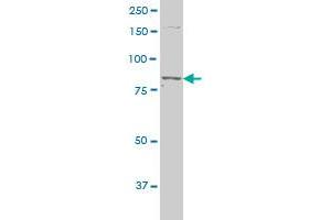 PRKCE polyclonal antibody (A01), Lot # 051024JC01 Western Blot analysis of PRKCE expression in NIH/3T3 .