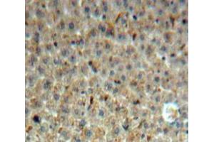 Used in DAB staining on fromalin fixed paraffin-embedded Liver tissue (INHBE antibody  (AA 102-344))
