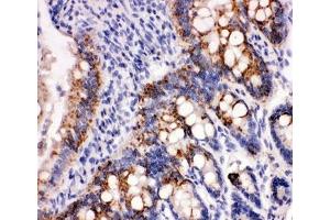 Peroxiredoxin 3 antibody and rat intestine tissue tested by IHC-P (Peroxiredoxin 3 antibody  (AA 239-256))