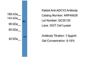 WB Suggested Anti-ADCY2  Antibody Titration: 0. (ADCY2 antibody  (Middle Region))