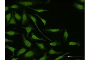 Immunofluorescence of purified MaxPab antibody to LIMK1 on HeLa cell. (LIM Domain Kinase 1 antibody  (AA 1-647))