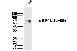 HeLa lysates probed with EIF4B (Ser406) Polyclonal Antibody, Unconjugated  at 1:300 dilution and 4˚C overnight incubation. (EIF4B antibody  (pSer406))