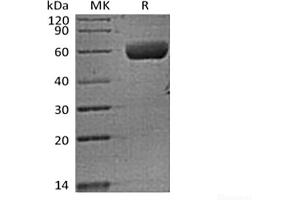FAM3B Protein (Fc Tag)