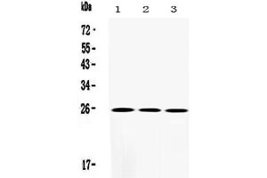 Western blot analysis of SOD2/Mnsod using anti-SOD2/Mnsod antibody .
