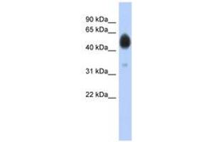 Image no. 1 for anti-Arylsulfatase A (ARSA) (AA 37-86) antibody (ABIN6743778) (Arylsulfatase A antibody  (AA 37-86))