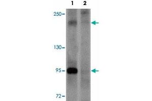 Western blot analysis of PAPPA2 in HeLa cell lysate with PAPPA2 polyclonal antibody  at 1 ug/mL in (1) the absence and (2) the presence of blocking peptide. (PAPPA2 antibody  (N-Term))