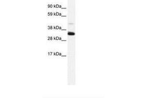 Image no. 2 for anti-Annexin A3 (ANXA3) (N-Term) antibody (ABIN202243) (Annexin A3 antibody  (N-Term))