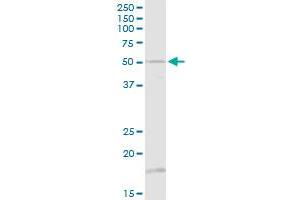 TUBB1 MaxPab rabbit polyclonal antibody. (TUBB1 antibody  (AA 1-451))